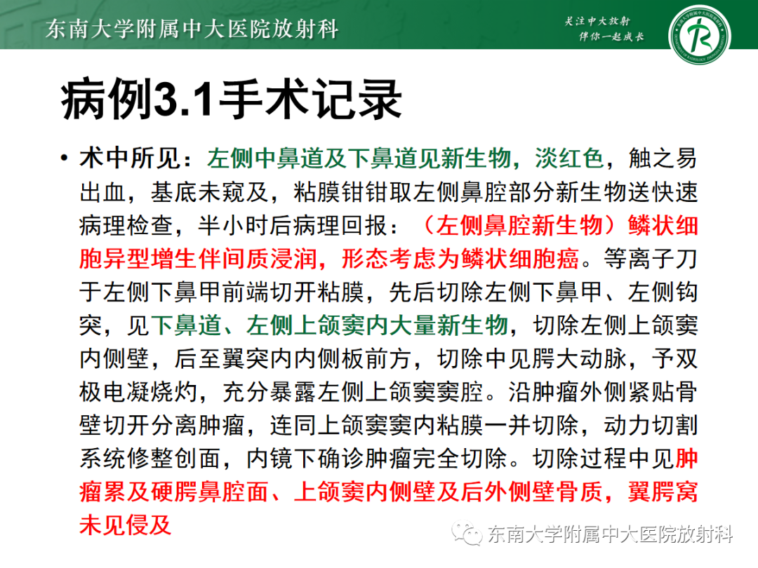 影像PPT - 【PPT】以上颌窦为中心的鼻腔鼻窦占位性病变随访-61