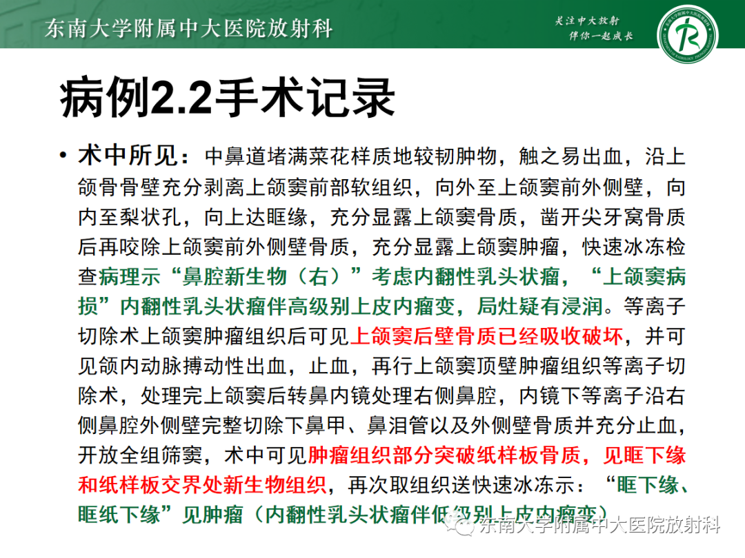 影像PPT - 【PPT】以上颌窦为中心的鼻腔鼻窦占位性病变随访-58