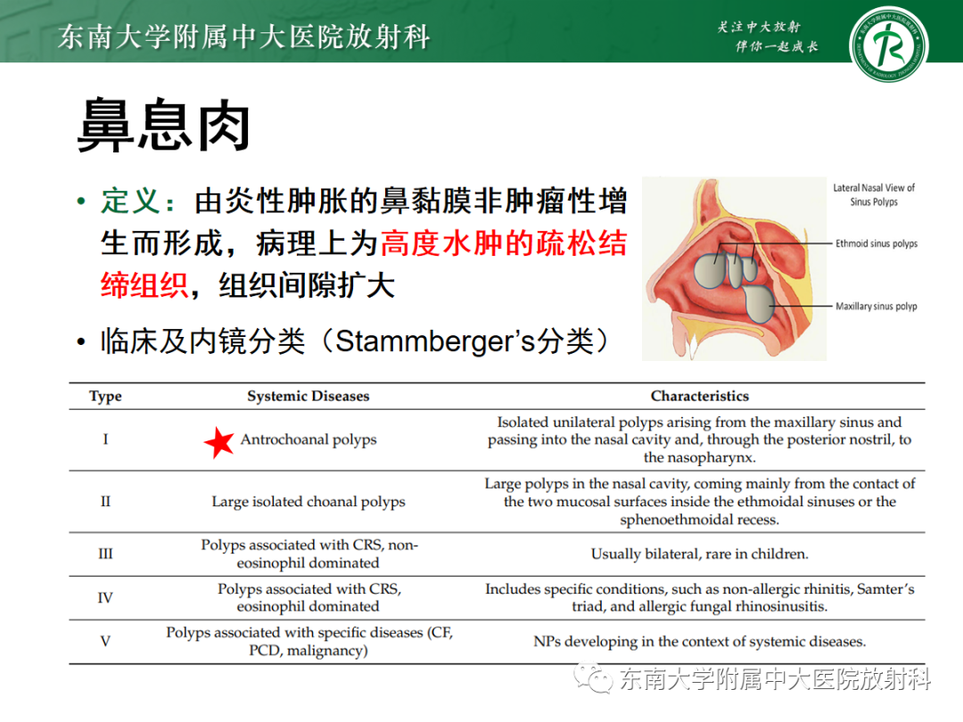 影像PPT - 【PPT】以上颌窦为中心的鼻腔鼻窦占位性病变随访-73
