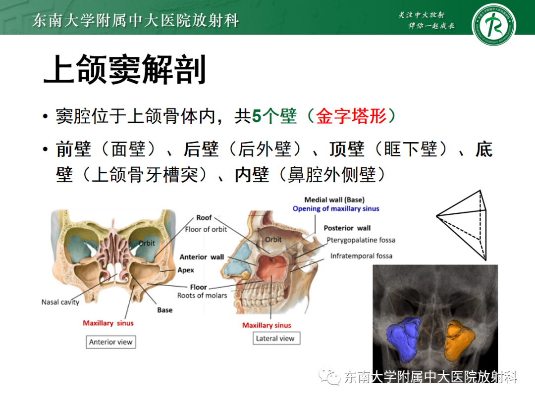 影像PPT - 【PPT】以上颌窦为中心的鼻腔鼻窦占位性病变随访-70