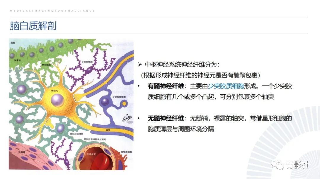 影像PPT - 【PPT】脑白质病变的影像诊断思路-5