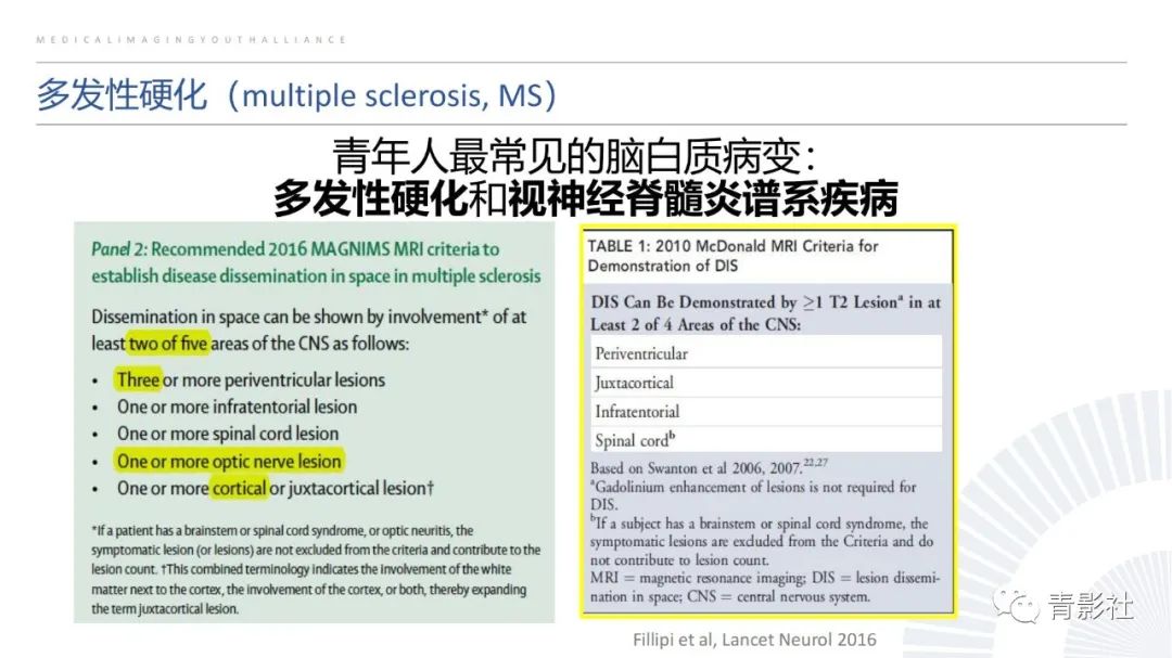 影像PPT - 【PPT】脑白质病变的影像诊断思路-9