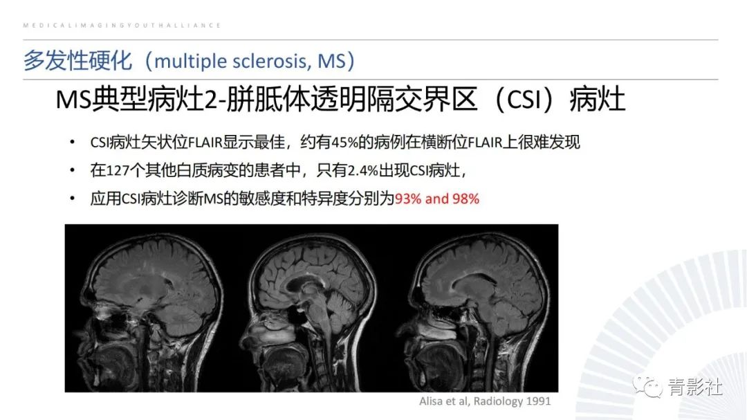 影像PPT - 【PPT】脑白质病变的影像诊断思路-11