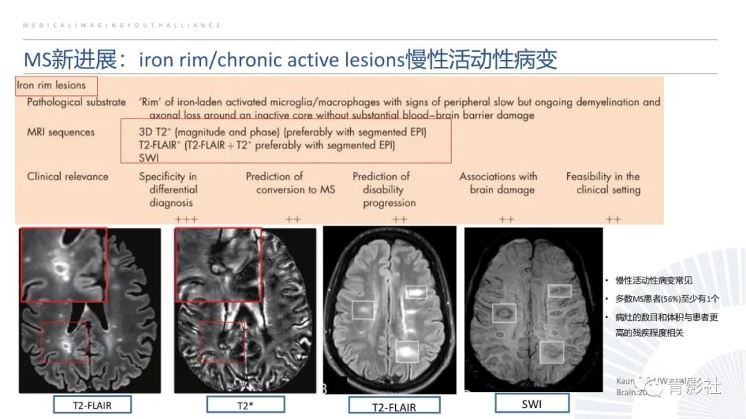 影像PPT - 【PPT】脑白质病变的影像诊断思路-16