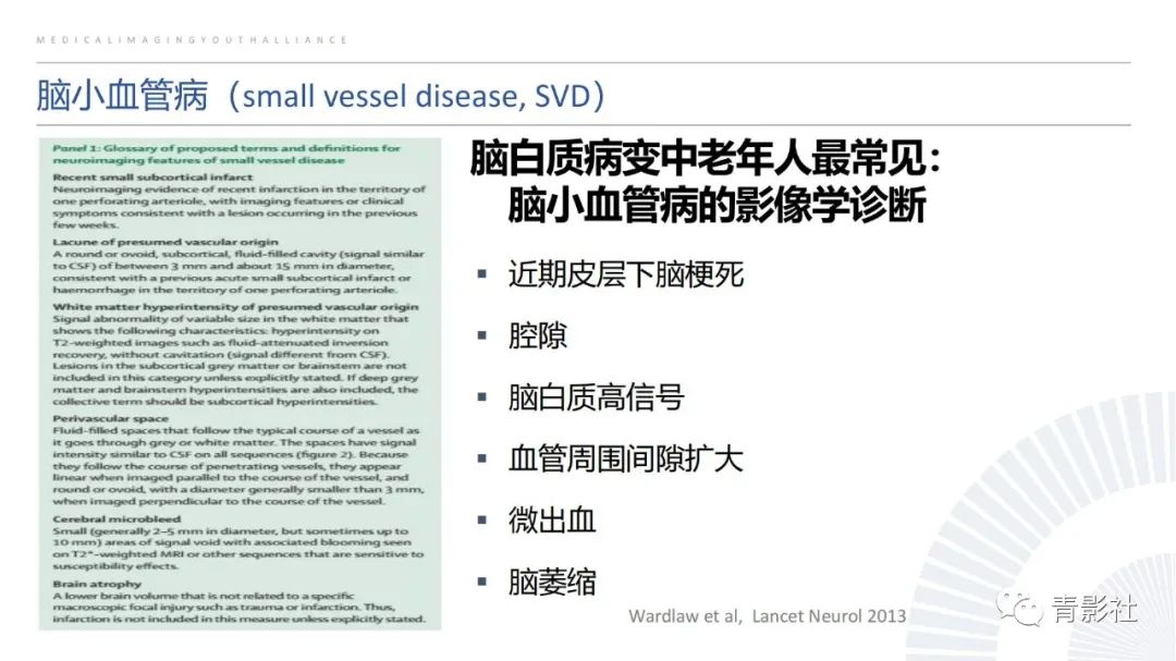 影像PPT - 【PPT】脑白质病变的影像诊断思路-23