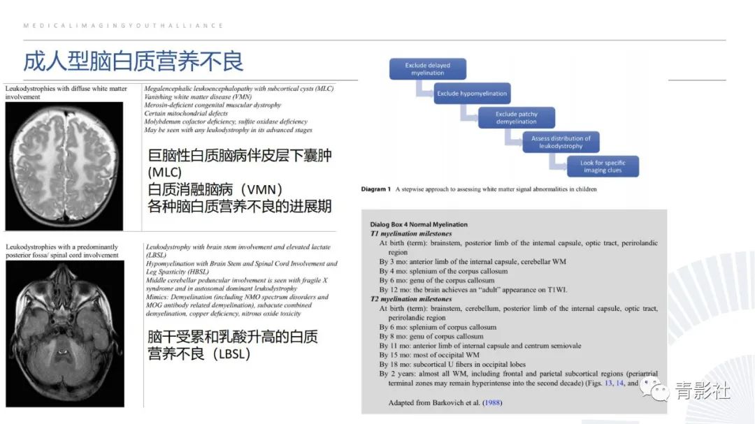 影像PPT - 【PPT】脑白质病变的影像诊断思路-36