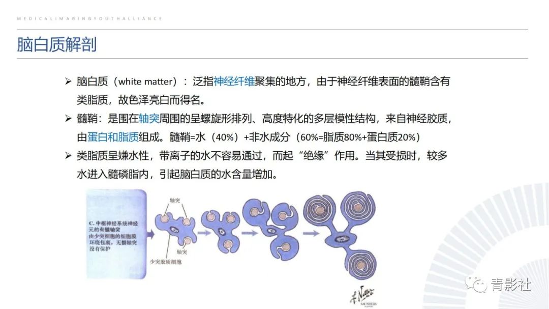 影像PPT - 【PPT】脑白质病变的影像诊断思路-1