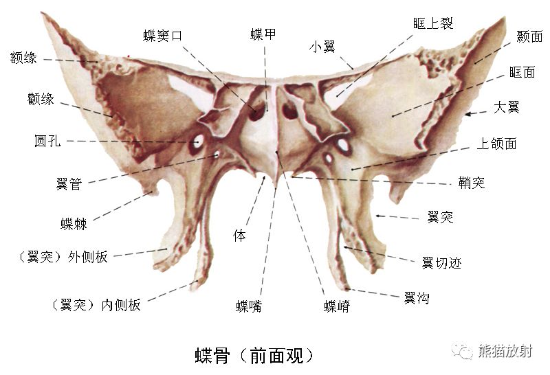 影像PPT - 蝶骨大翼解剖及相关疾病-3 影像PPT - 蝶骨大翼解剖及相关疾病-3
