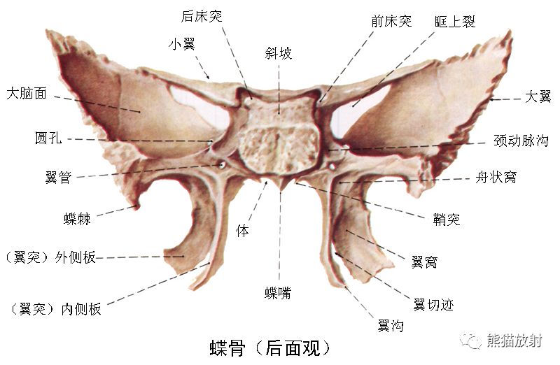 影像PPT - 蝶骨大翼解剖及相关疾病-4 影像PPT - 蝶骨大翼解剖及相关疾病-4