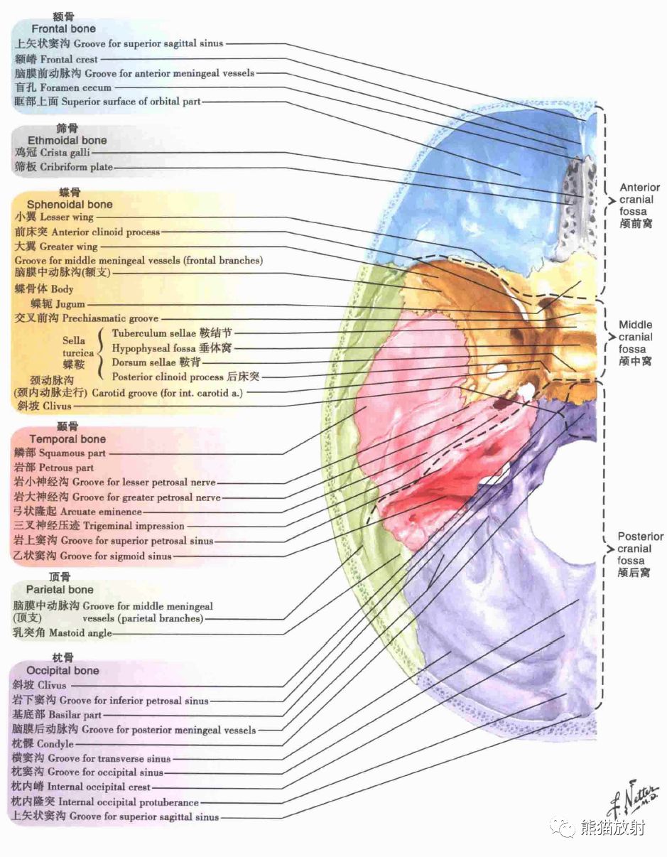 影像PPT - 蝶骨大翼解剖及相关疾病-6 影像PPT - 蝶骨大翼解剖及相关疾病-6