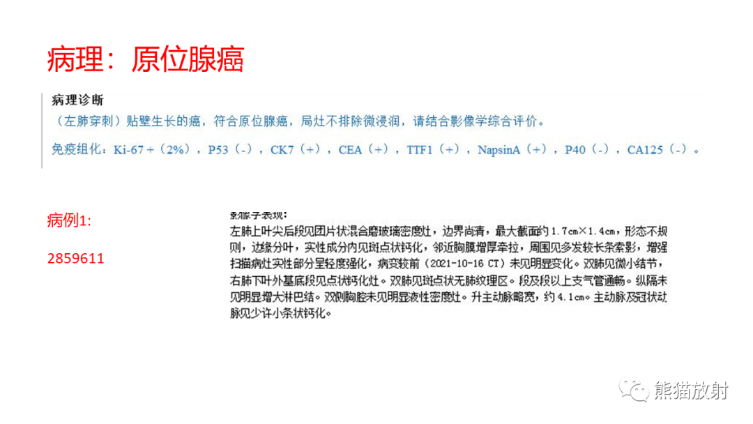 影像PPT - 【病例】肺原位腺癌 VS 浸润性腺癌-8