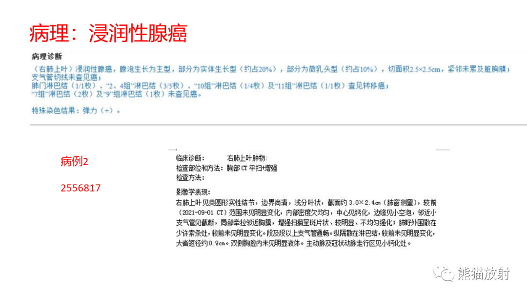 影像PPT - 【病例】肺原位腺癌 VS 浸润性腺癌-9