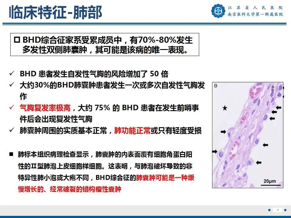 影像PPT - 【PPT】Birt-Hogg-Dubé综合征-18