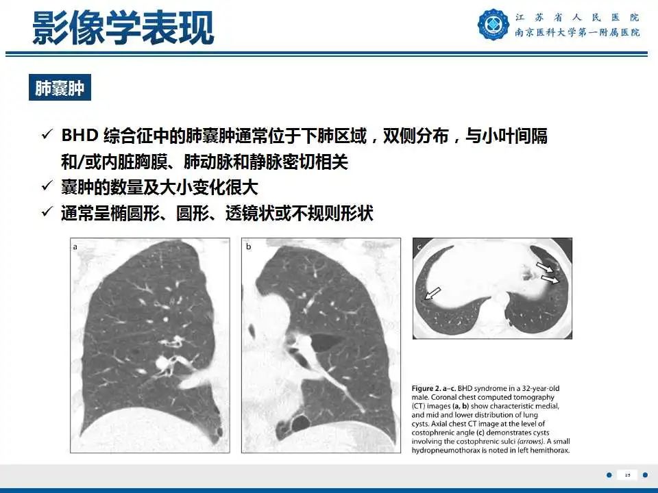 影像PPT - 【PPT】Birt-Hogg-Dubé综合征-26