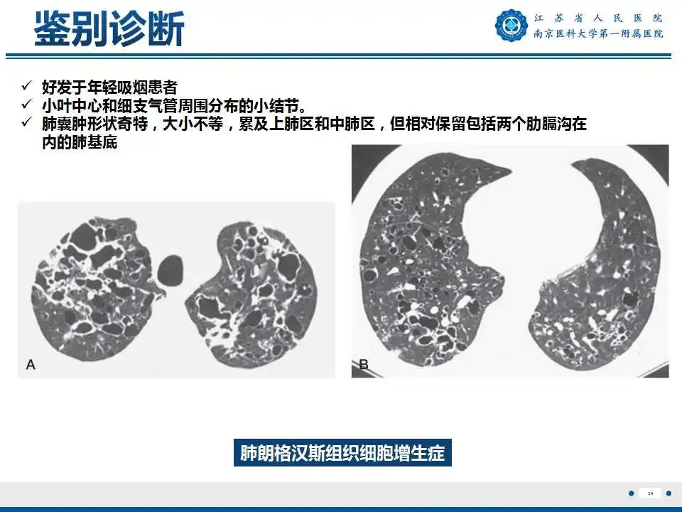 影像PPT - 【PPT】Birt-Hogg-Dubé综合征-35