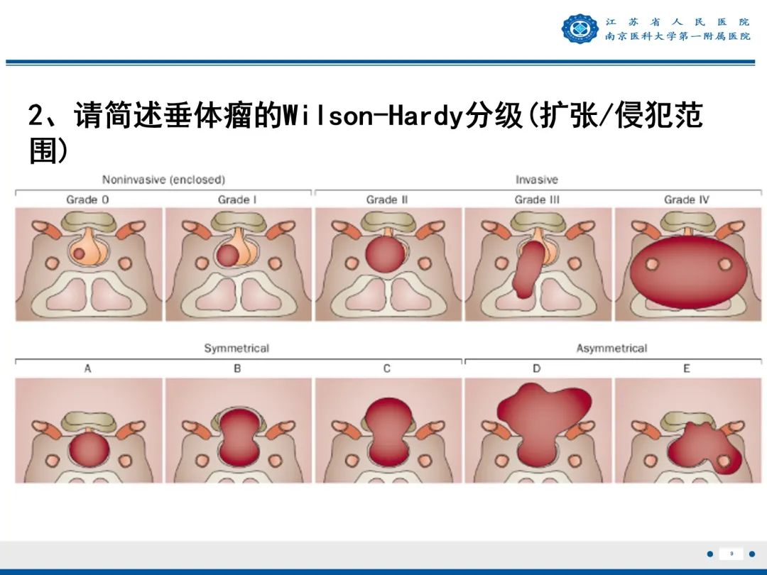 影像PPT - 【PPT】垂体腺瘤-10