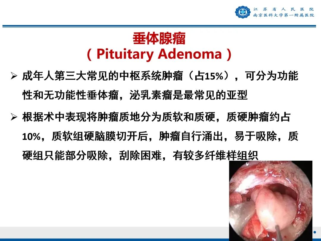 影像PPT - 【PPT】垂体腺瘤-18
