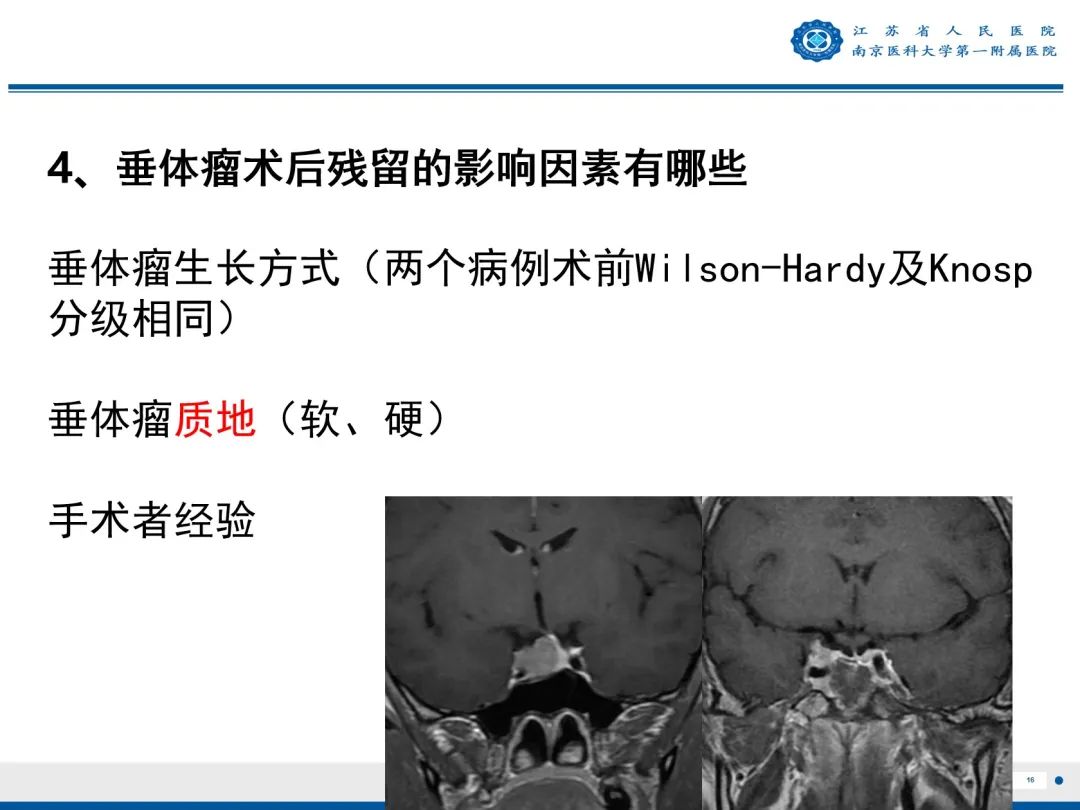 影像PPT - 【PPT】垂体腺瘤-17