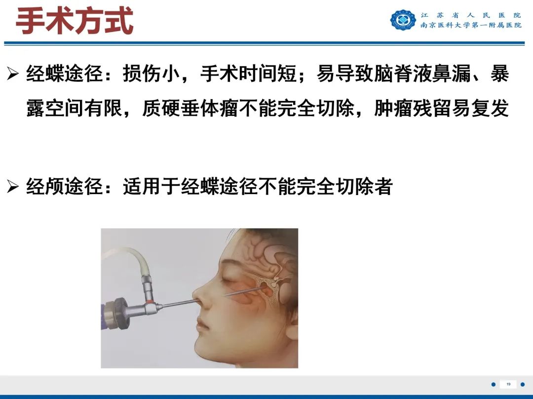 影像PPT - 【PPT】垂体腺瘤-20