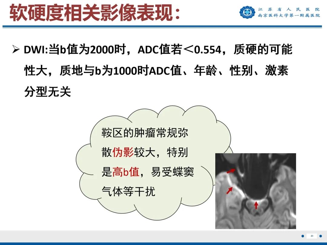 影像PPT - 【PPT】垂体腺瘤-24