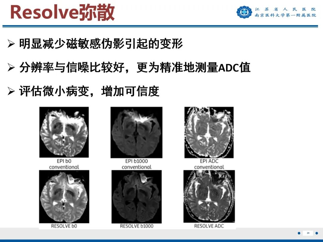 影像PPT - 【PPT】垂体腺瘤-25