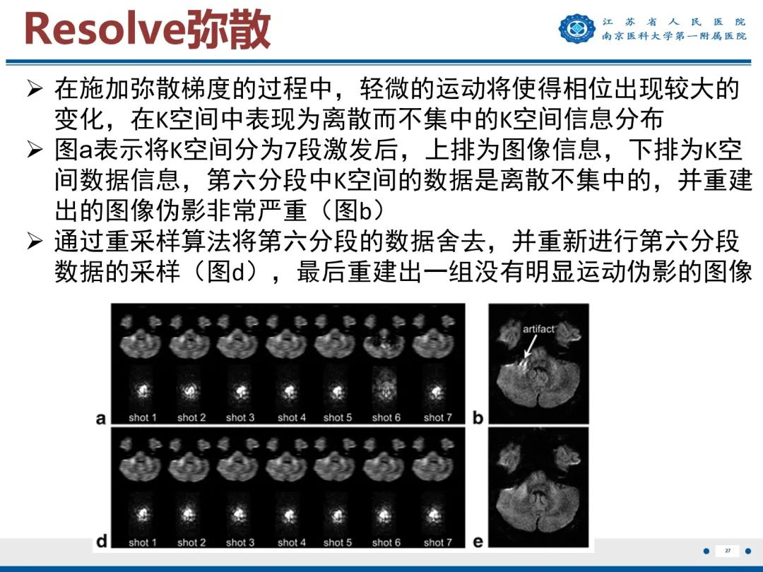 影像PPT - 【PPT】垂体腺瘤-28