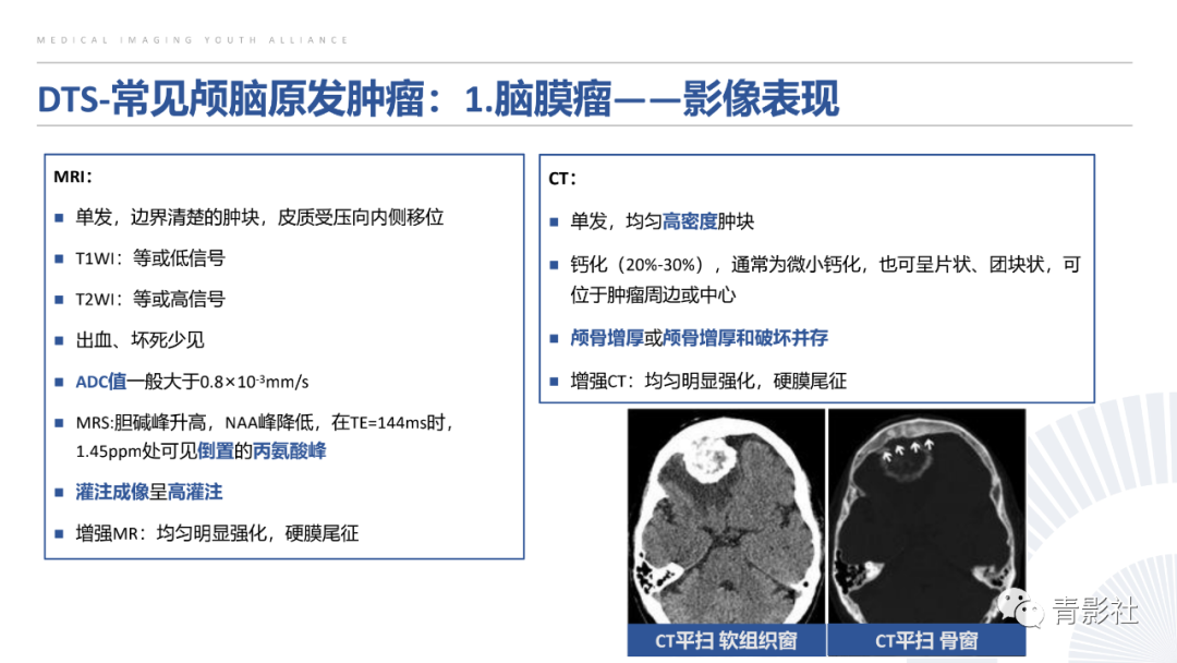 影像PPT - 【PPT】颅脑硬膜尾征：beyond meningioma-14