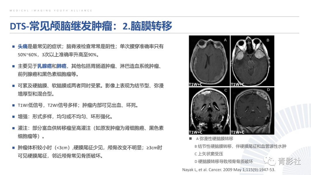 影像PPT - 【PPT】颅脑硬膜尾征：beyond meningioma-17