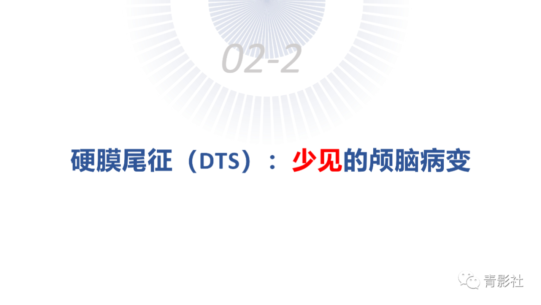 影像PPT - 【PPT】颅脑硬膜尾征：beyond meningioma-19