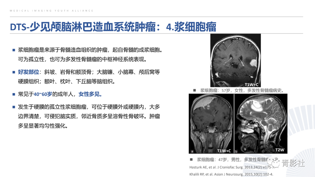 影像PPT - 【PPT】颅脑硬膜尾征：beyond meningioma-28