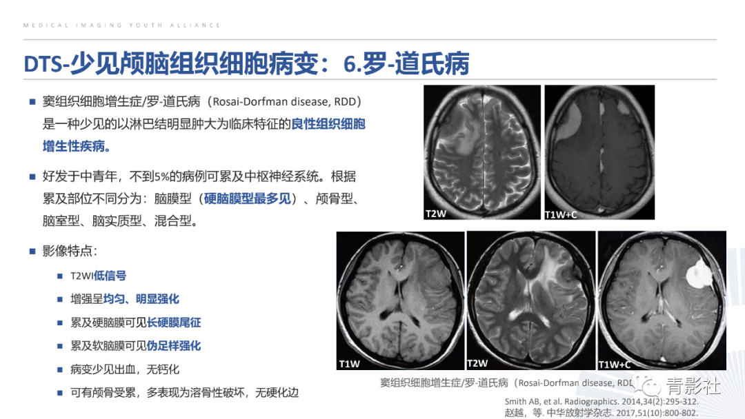 影像PPT - 【PPT】颅脑硬膜尾征：beyond meningioma-30