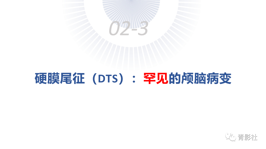 影像PPT - 【PPT】颅脑硬膜尾征：beyond meningioma-32