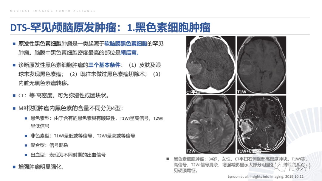 影像PPT - 【PPT】颅脑硬膜尾征：beyond meningioma-33