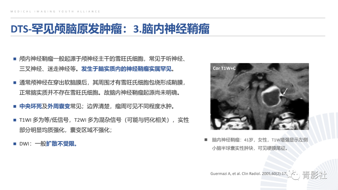 影像PPT - 【PPT】颅脑硬膜尾征：beyond meningioma-35