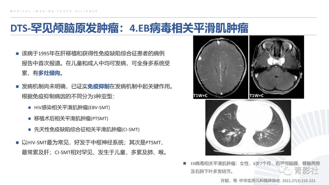 影像PPT - 【PPT】颅脑硬膜尾征：beyond meningioma-36
