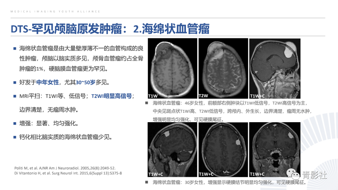 影像PPT - 【PPT】颅脑硬膜尾征：beyond meningioma-34