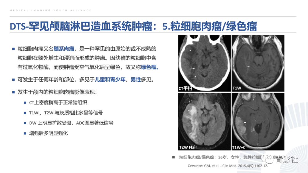 影像PPT - 【PPT】颅脑硬膜尾征：beyond meningioma-37