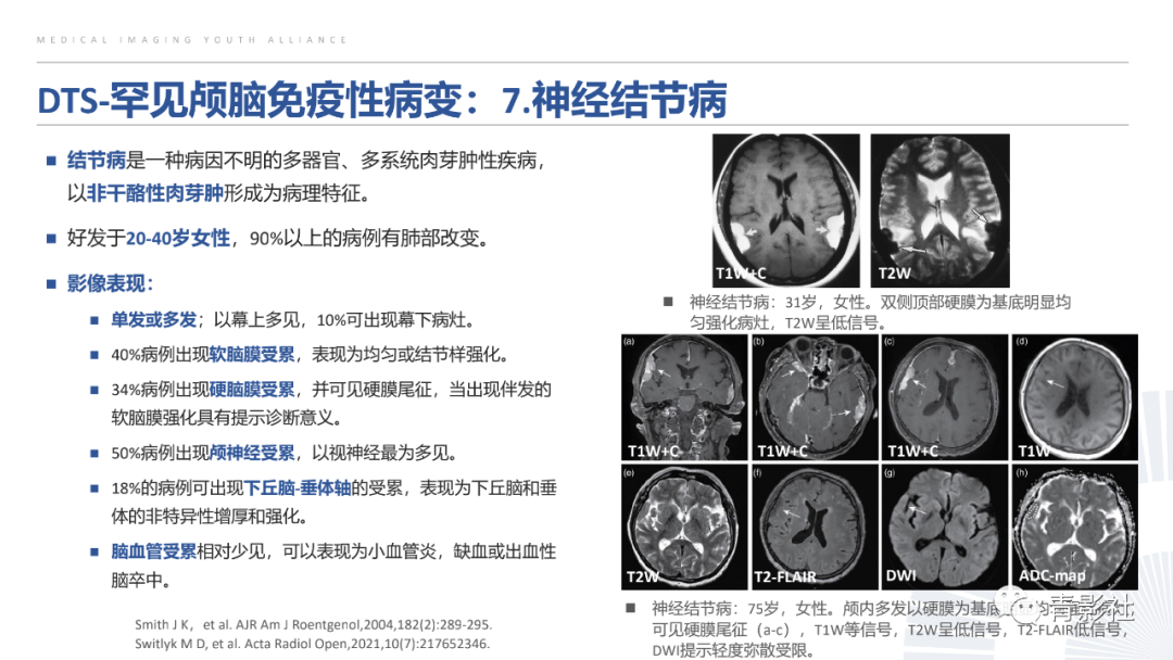 影像PPT - 【PPT】颅脑硬膜尾征：beyond meningioma-39