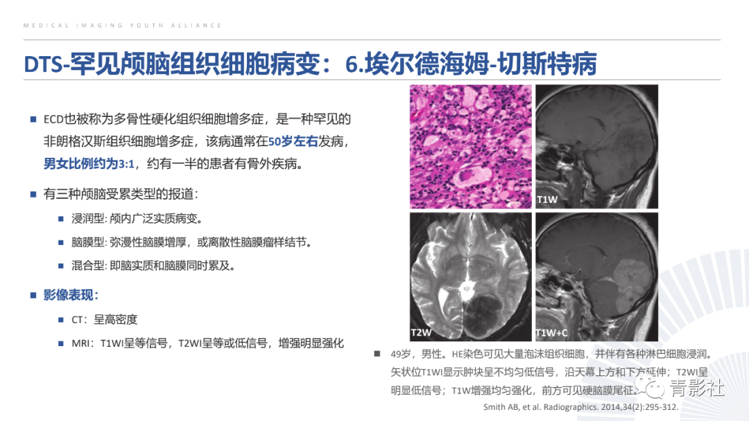 影像PPT - 【PPT】颅脑硬膜尾征：beyond meningioma-38