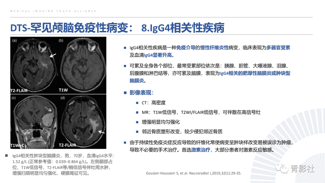 影像PPT - 【PPT】颅脑硬膜尾征：beyond meningioma-40