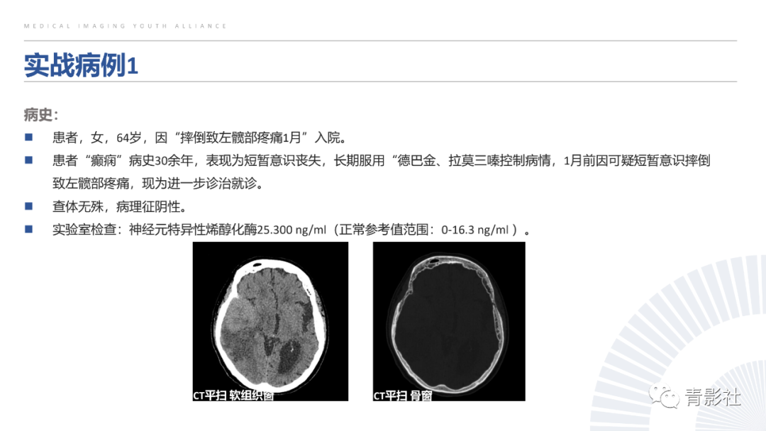 影像PPT - 【PPT】颅脑硬膜尾征：beyond meningioma-46