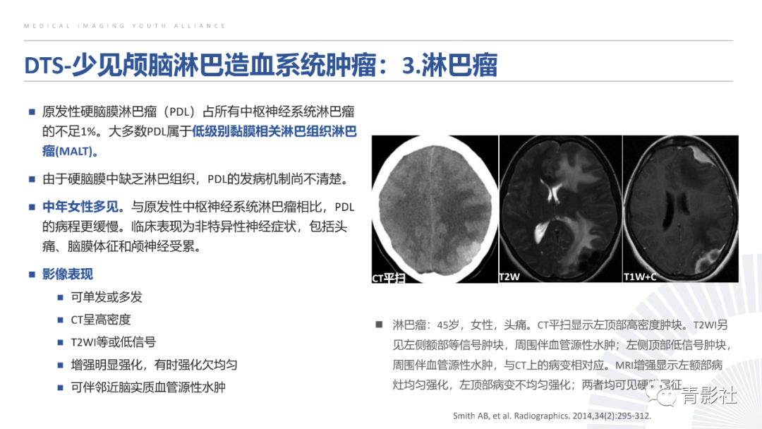 影像PPT - 【PPT】颅脑硬膜尾征：beyond meningioma-4