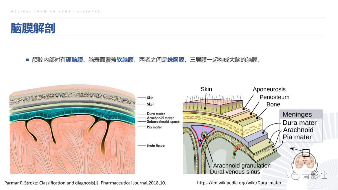 影像PPT - 【PPT】颅脑硬膜尾征：beyond meningioma-1
