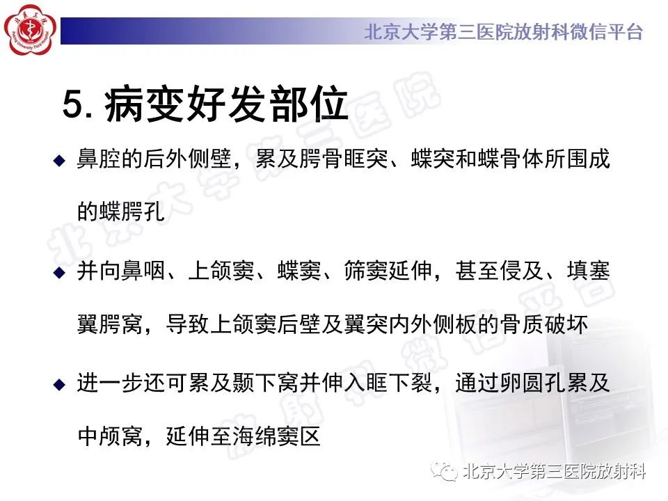影像PPT - 【PPT】鼻咽纤维血管瘤-12