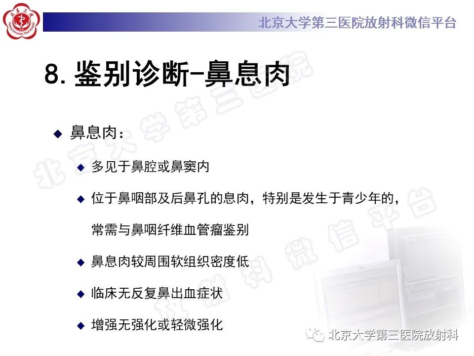 影像PPT - 【PPT】鼻咽纤维血管瘤-23