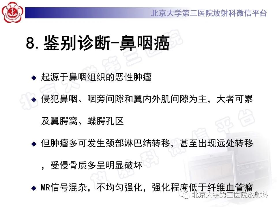 影像PPT - 【PPT】鼻咽纤维血管瘤-25