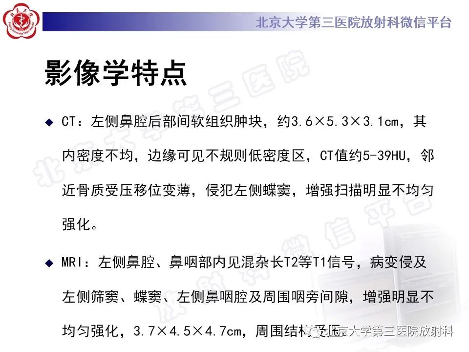 影像PPT - 【PPT】鼻咽纤维血管瘤-1