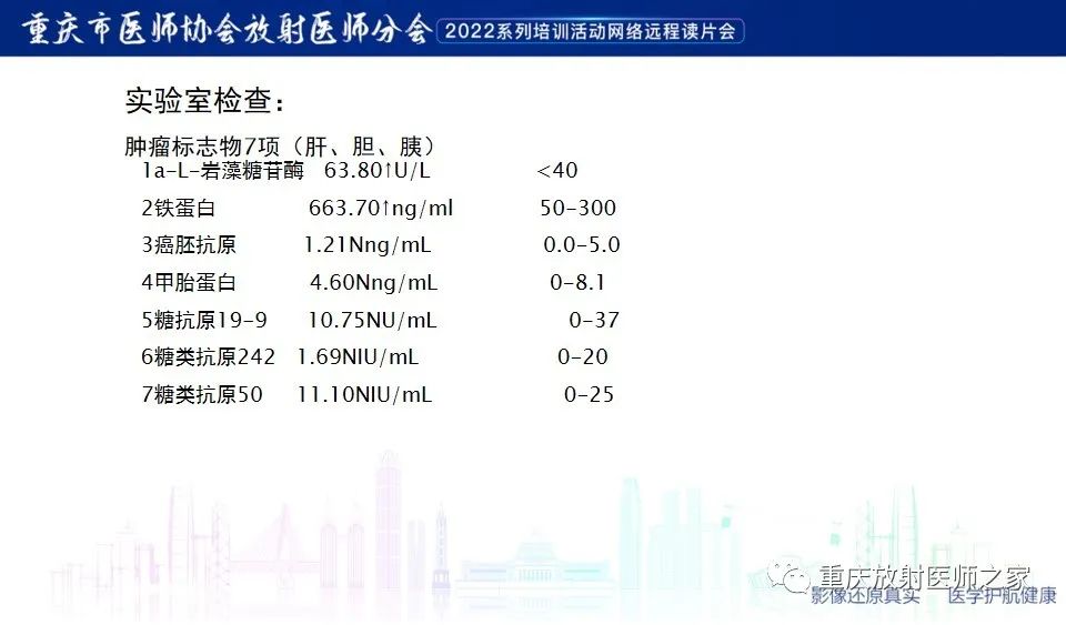 影像PPT - 【病例】肿块型胰腺炎1例CT及MR-3