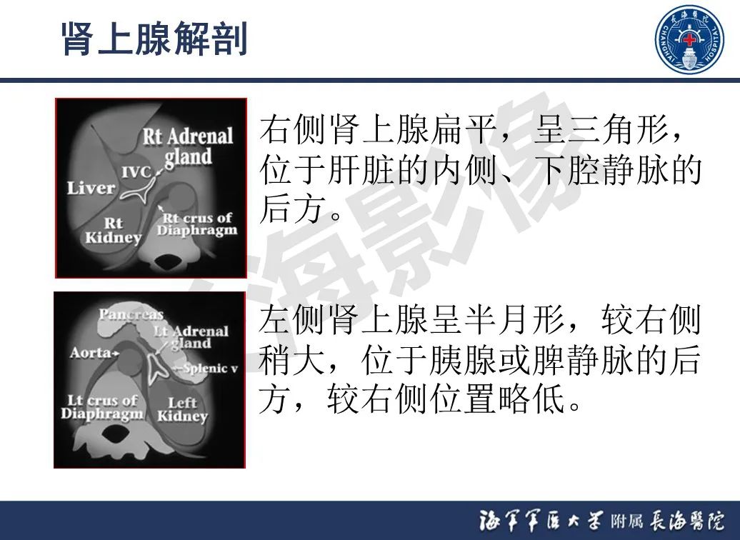 影像PPT - 【PPT】肾上腺占位影像诊断-2
