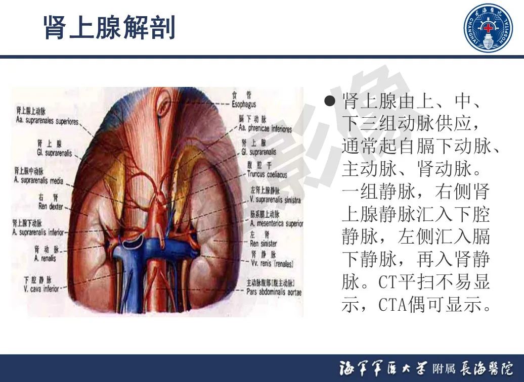 影像PPT - 【PPT】肾上腺占位影像诊断-3